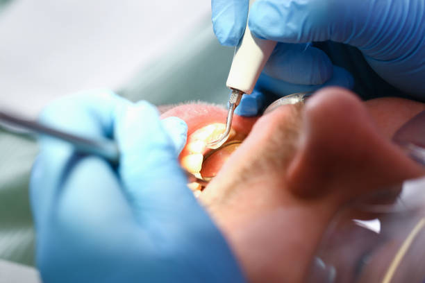 Best Emergency Treatment for Jaw Pain or Injury in Cuyahoga Falls, OH