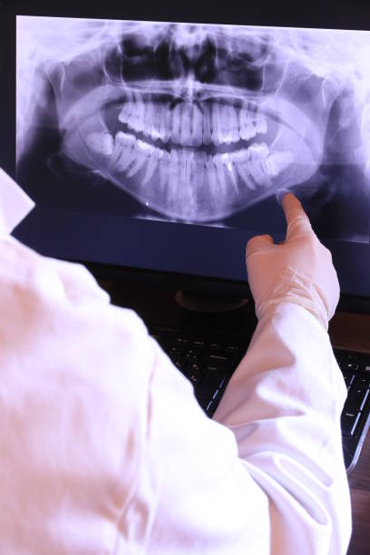 Best Knocked-Out Tooth (Avulsed Tooth) Treatment in Cuyahoga Falls, OH